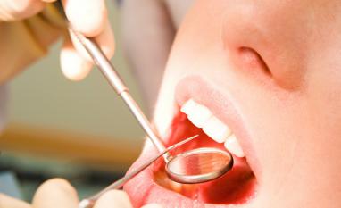 牙周病的原因是什么？